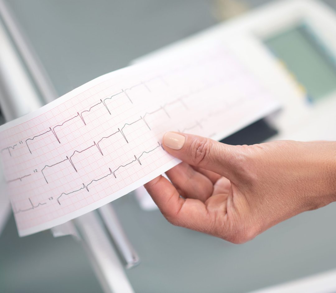 Close up of doctors hand with electrocardigram result